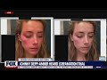 Johnny Depp lawyer accuses Amber Heard of doctoring injury photos LiveNOW from FOX thumbnail 2
