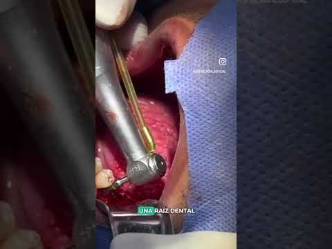 video YkzXh0kAIdg