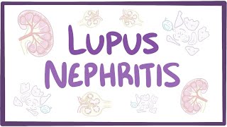 Download lagu Lupus nephritis - causes, symptoms, diagnosis, treatment, pathology mp3 Download lagu Lupus nephritis - causes, symptoms, diagnosis, treatment, pathology mp3