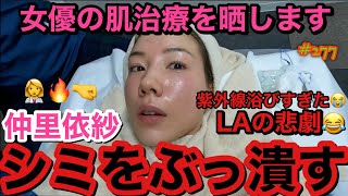 女優の肌治療?‍⚕️シミをぶっ潰しに行ったけどこの女はどんな時でもふざけ出すのは誰遺伝？