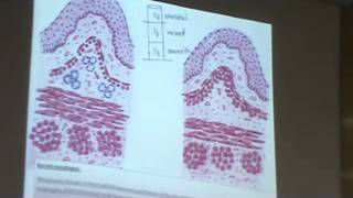 Dr Gihan Esophagus 23-10-2013