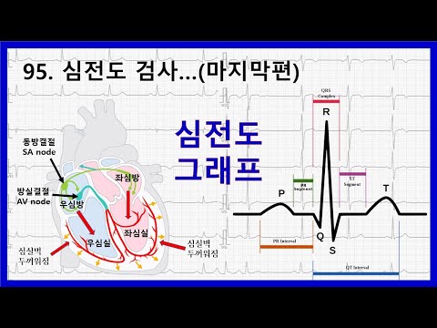 95. 심전도  검사에 대하여 - 심전도 그래프 설명
