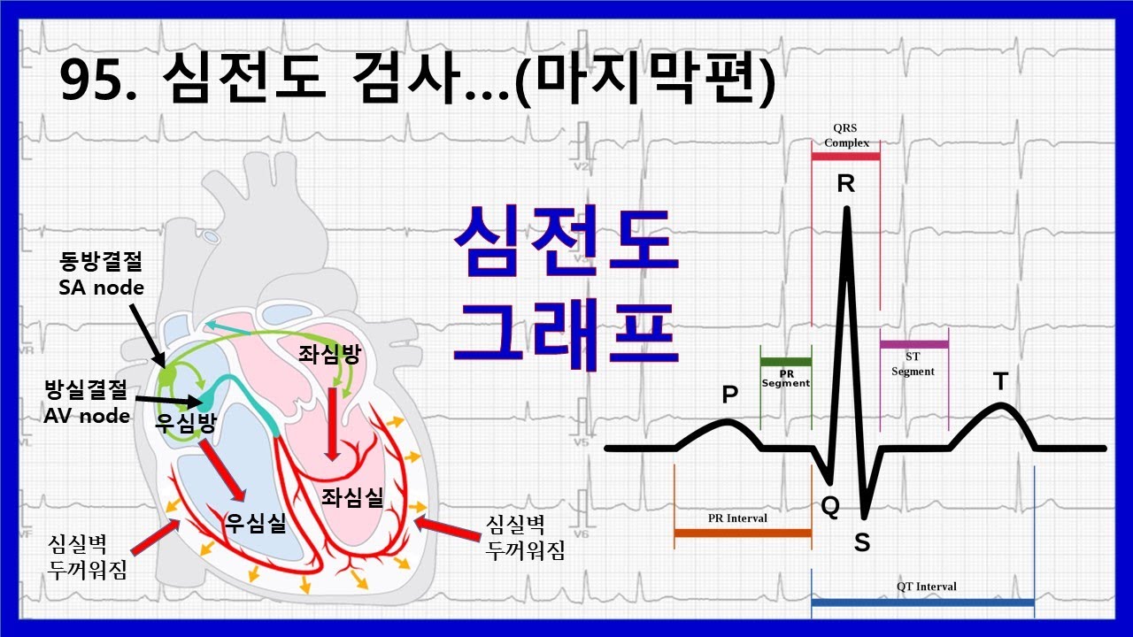 95. 심전도  검사에 대하여 - 심전도 그래프 설명