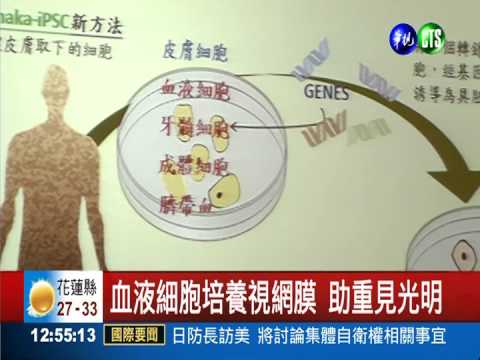 北榮研究:血液細胞可變成視網膜