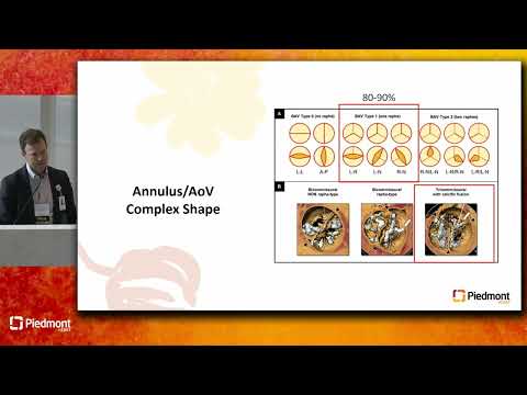 Management Of Bicuspid Aortic Valve Disease