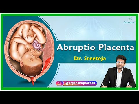 Placental abruption (abruptio placentae) : Causes, Clinical presentation, Diagnosis and Treatment