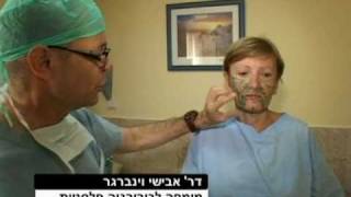 הזרקות שומן למילוי פנים - אבישי וינברגר