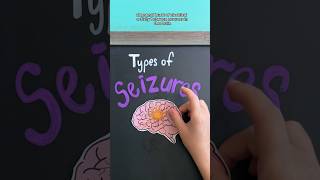 SEIZURE TYPES EXPLAINED #nursingschool