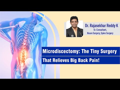 Microdiscectomy: the tiny surgery that relieves big back pain