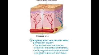 Tissue Repair