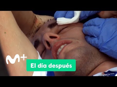 El Día Después (02/10/2017): Partido loco en Anoeta