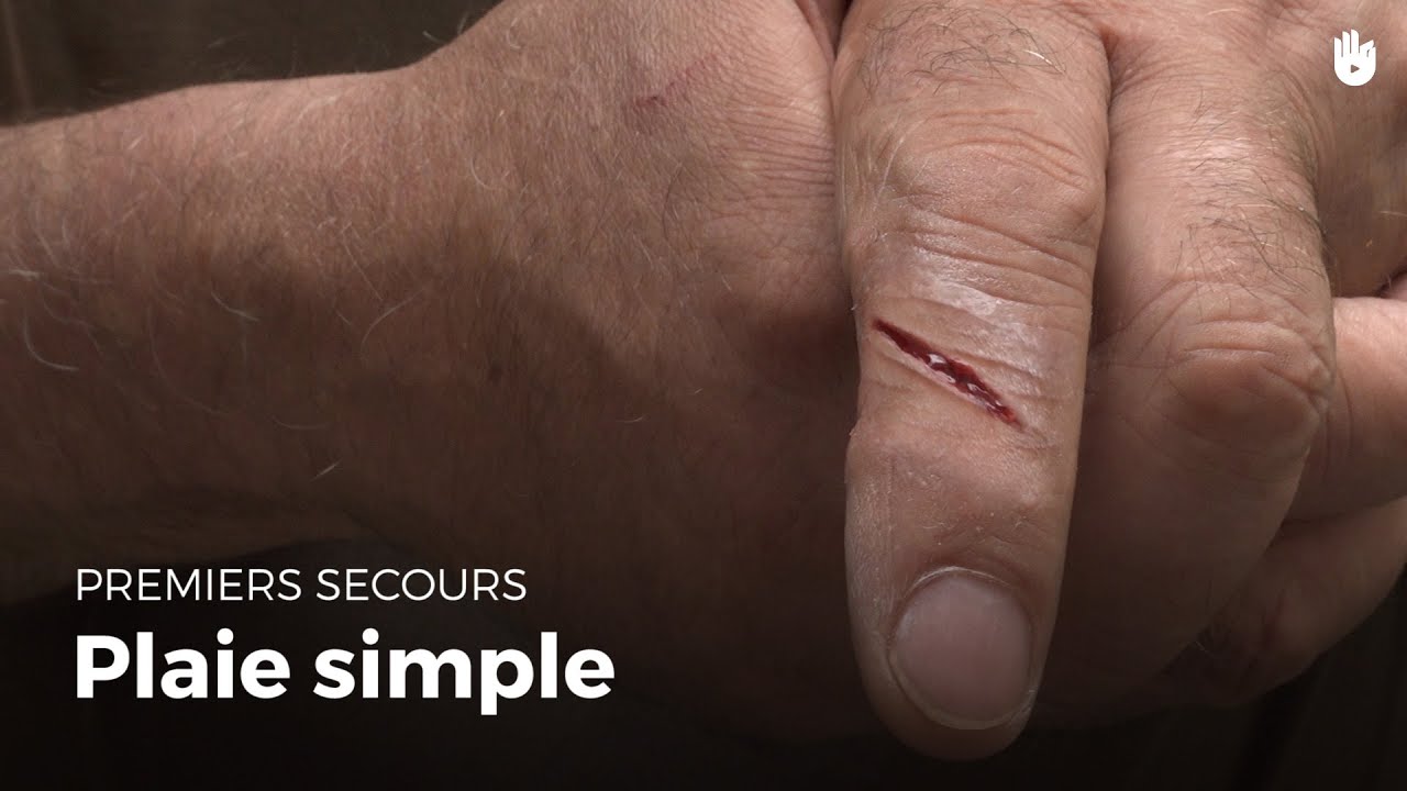 Premiers secours: Plaie simple - Les gestes de premier secours | Sikana