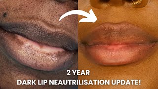 Lip tattoo on DARK lips....my 2 year update (do I regret it?)