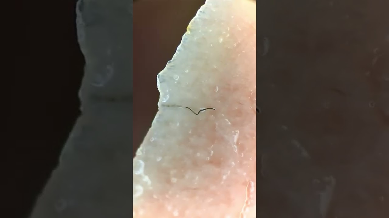 Are there bugs in canned tuna? Tipseri