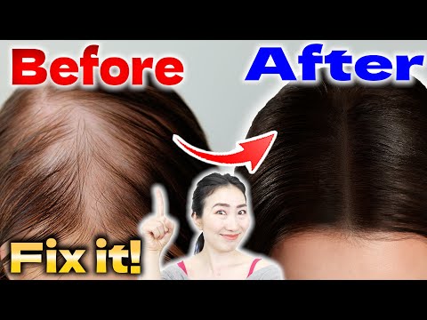Boost Hair Growth in 45 days by Elevating Scalp Blood Flow with Easy Massage Techniques