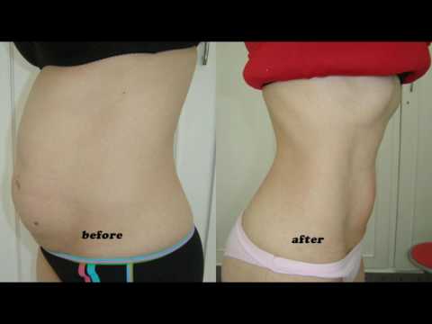 Resulta Slimming Belt Peas pinakuluang calorie protina fats carbohydrates