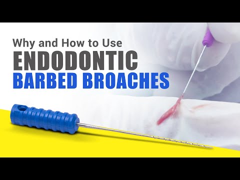 Correct way to use barbed broaches #Endodontics