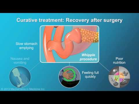 Pancreatic Cancer: Treatment and Outcomes