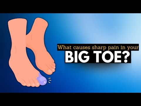 Big Toe Pain: Unmasking the Culprits Behind Sharp Aches