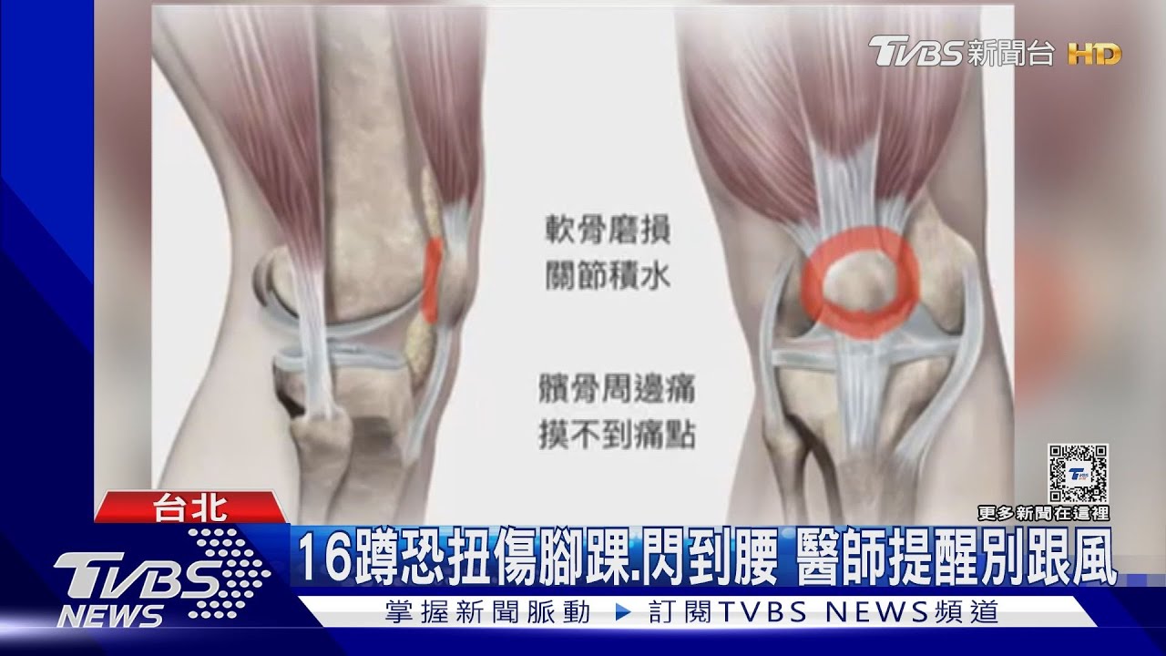 16蹲摩擦軟骨　醫：退化性關節炎恐加速