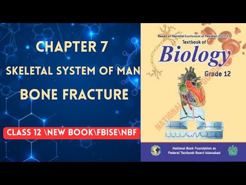 BONE FRACTURES| Chapter 7|CLASS 12|Biology|National book foundation |NBF NEW BOOK 2025