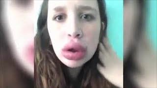 Девушки УВЕЛИЧЕНИЕ ГУБ !!!!
