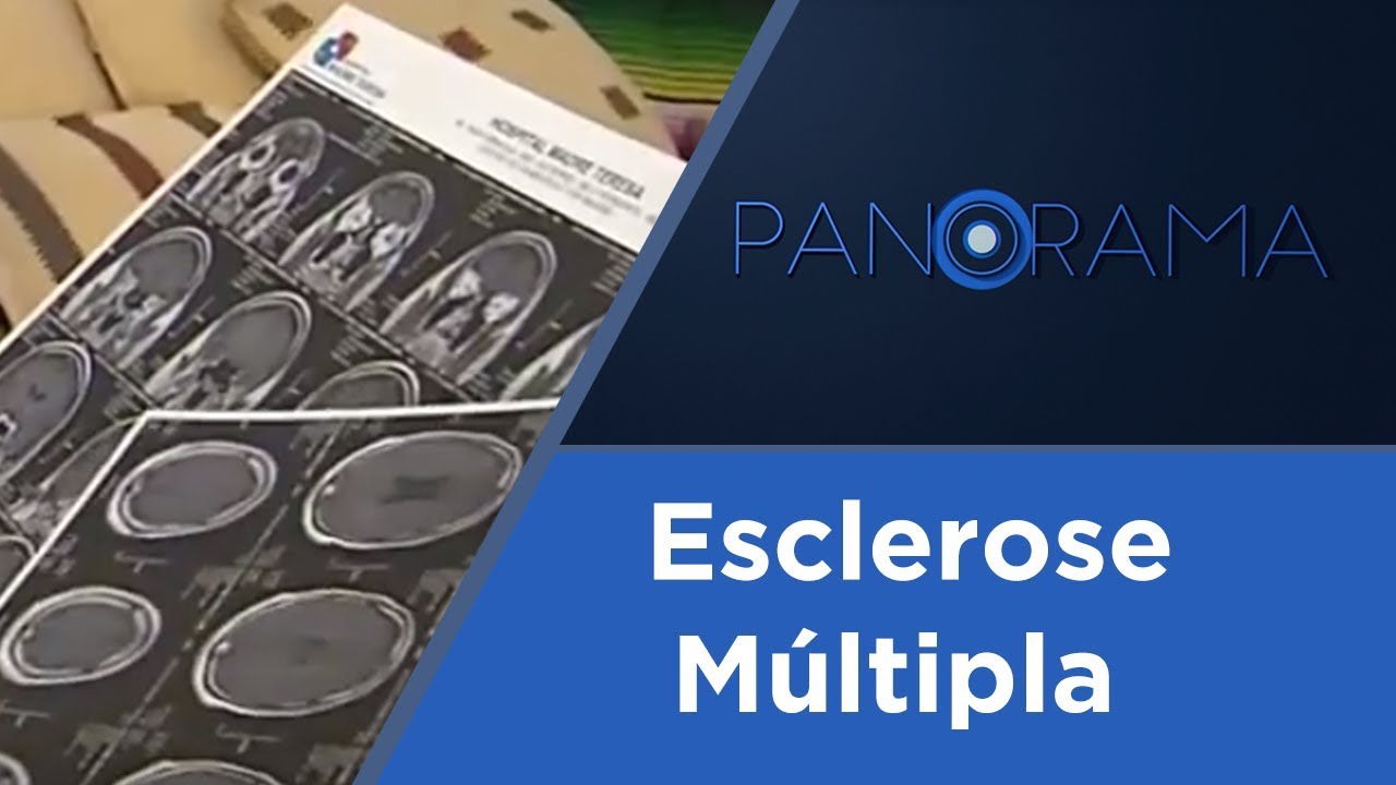 Panorama | Esclerose Múltipla | 30/08/2017