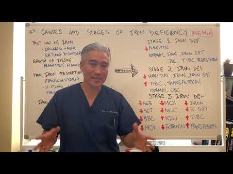 Iron Deficiency ANEMIA🧟‍♀️. Made Simple.