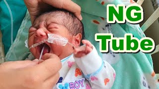 Nasogastric (NG) Tube Insertion in Neonate/Newborn | Orogastric (OG) Tube/Feeding Tube | Paediatric