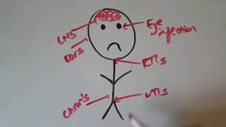 Ciprofloxacin -  Drug Discovery UEA MPharm year 2