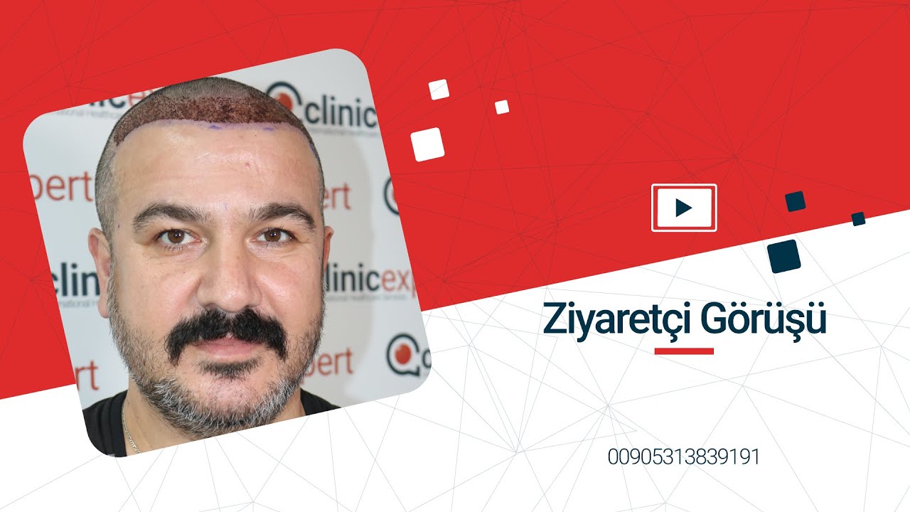 Saç Ekimi ve Estetik Cerrahi