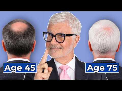 Balding/Thinning Hair at 45, Now I have a Full Head of Hair By Doing This!