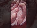 Chronic kidney disease | glomerulus animation | #glomerulus #CKDanimation #kidneyanimation