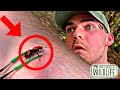 STUNG by a COW KILLER VELVET ANT