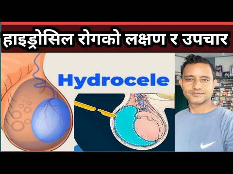 Hydrocele details in Nepali! हाइड्रोसिल कसरी हुन्छ यसको लक्षण तथा औषधि उपचार कसरी गर्ने?