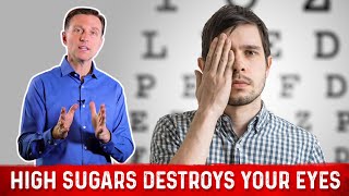 Causes of Eye Problems: High Blood Sugar &amp; Insulin – Dr. Berg