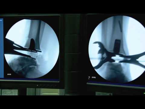 A pieno mal di schiena respiro Mal di sterno della colonna vertebrale toracica osteocondrosi