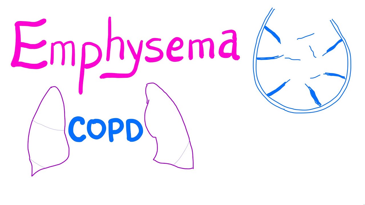 Emphysema - COPD - Pulmonary Medicine