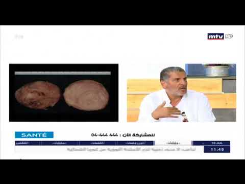 IVF Lebanon | Dr. Ghassan Azar Interview