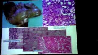 1_ Dr. Faisal  Cell Injury Fatty Change part 2