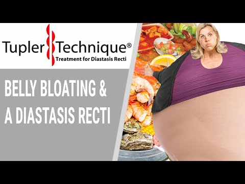 Belly Bloating and a Diastasis Recti- Julie Tupler, RN