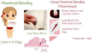 Heavy Menstrual Bleeding - What causes heavy periods?  how much menstruation is normal?