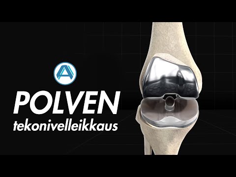 Polven tekonivelleikkaus | AniMed