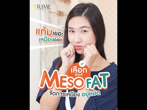 เมโสแฟต ยี่ห้อไหนดี