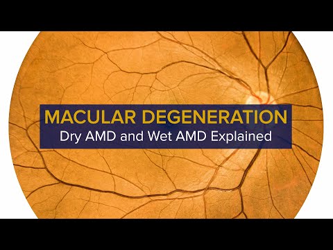 Macular Degeneration - Diagnosis, Symptoms & Treatment of Dry and Wet AMD | UC Davis Health