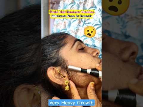 Facial Hair Remover Machine | Sideburns Gone in Seconds! #facialhairremoval #sideburns