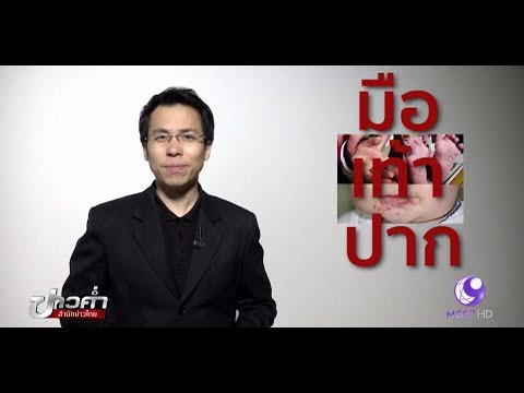 ไม่ SDA กลาก ฉีดของโรคสะเก็ดเงินในยูเครน