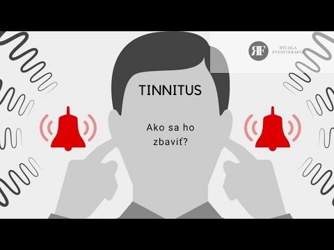 Tinnitus -  AKO NA TO !  Rýchla Fyzioterapia