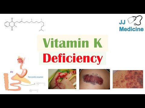 Vitamin K Deficiency | Dietary Sources, Causes, Symptoms, Diagnosis, Treatment