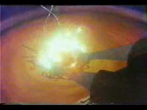 Secret of NIMH - TV Spots (1982)